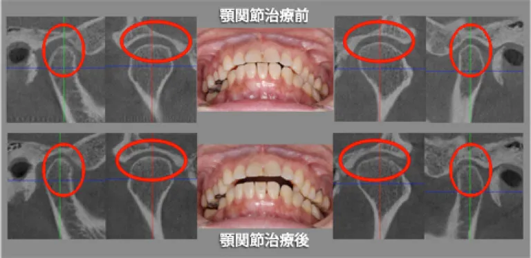 3次元診断と顎関節の精密診断