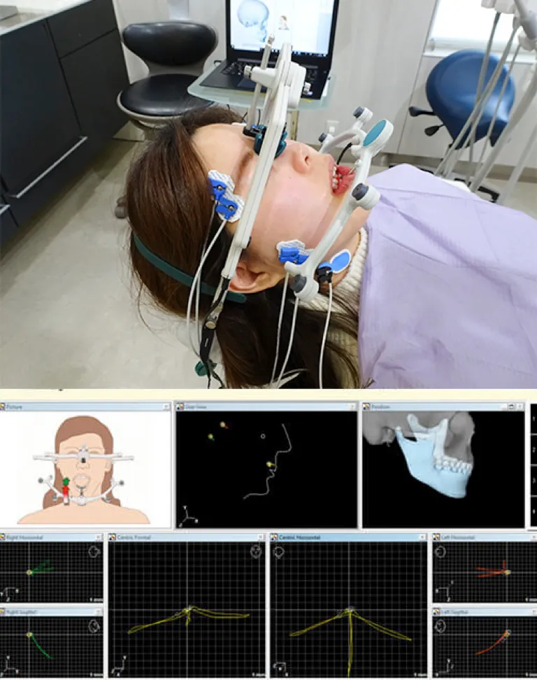 顎関節運動機能解析機の画像